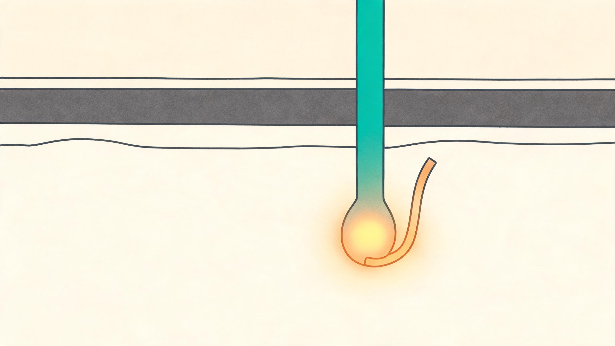 Schematic: long-pulse 1064 nm light passing the epidermis and heating a deep hair follicle and a vein